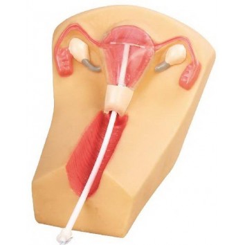IUD PLACEMENT TRAINING SIMULATOR (SOFT)